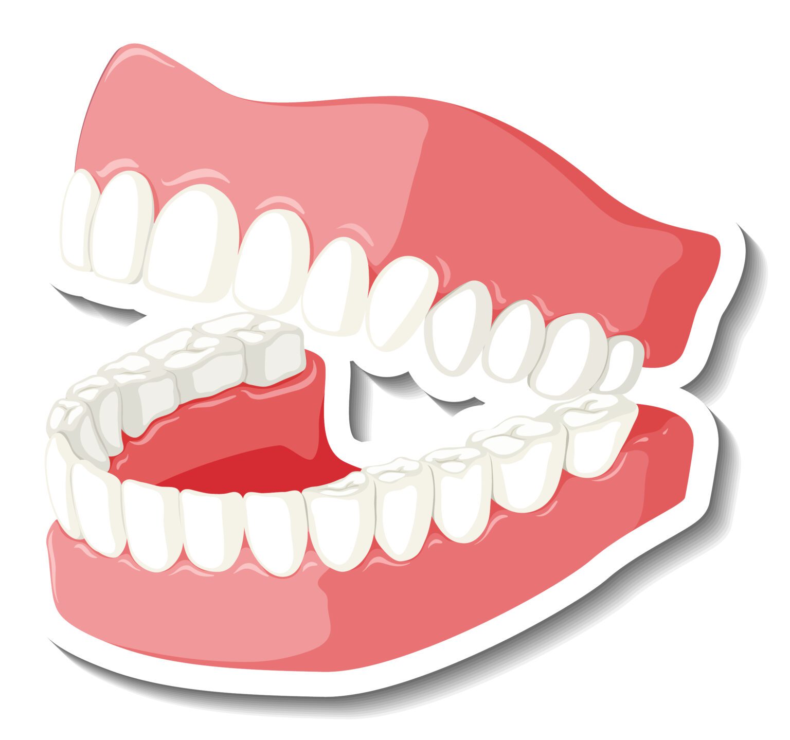 How Denture Implants Help You Prevent Jawbone Deterioration