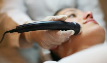 A professional administering Laser Treatment in Sydney for skin rejuvenation