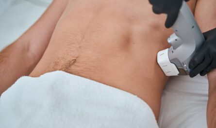 A CoolSculpting technician in Denver applying the specialized applicator to a patient's target area