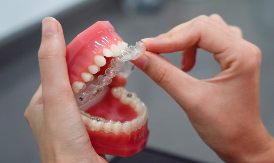 The Effectiveness of Invisalign for Different Dental Issues